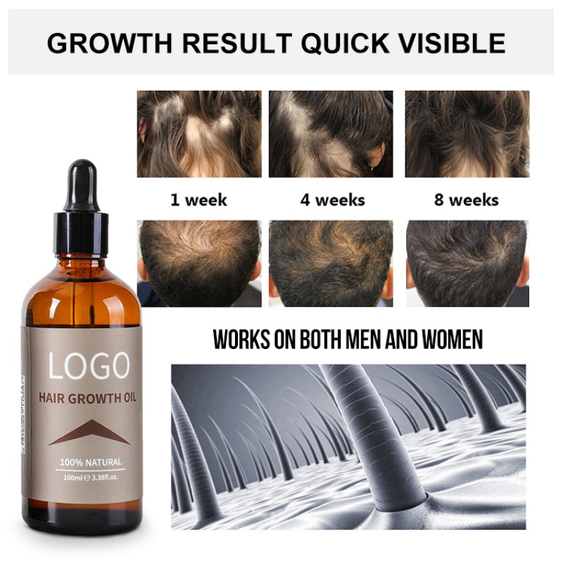 Hair Growth Serum Factory - Bulk 7 Days Essential Oil Natural Organic
