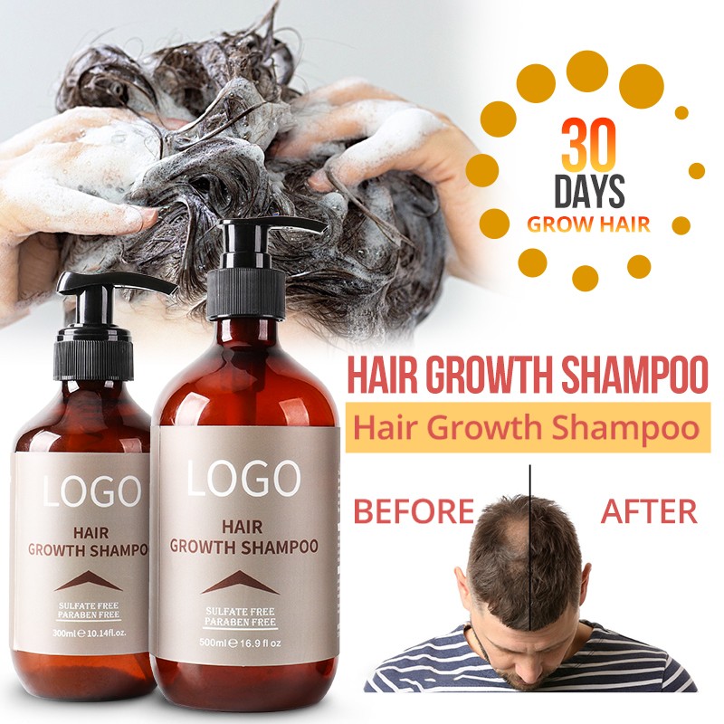 Hair Regrowth Shampoo Factory - Bulk Cheap Price Anti Hair Loss