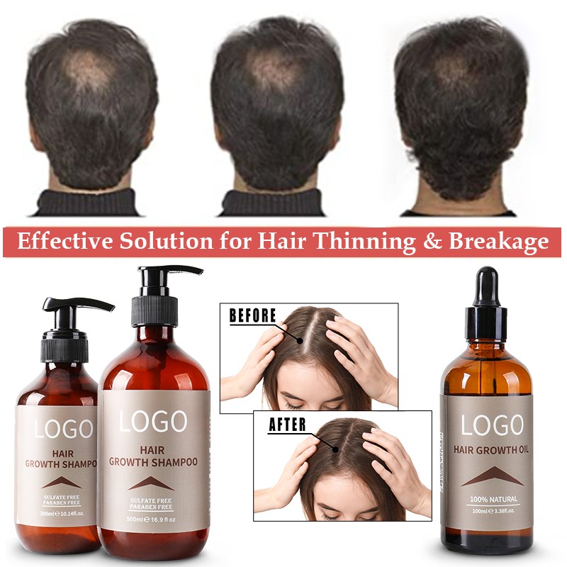 Hair Regrowth Shampoo Factory - Bulk Cheap Price Anti Hair Loss