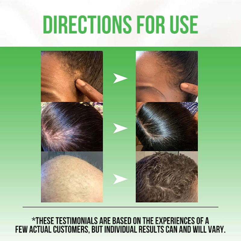 Hair Growth Oil Manufacturer - Bulk Ginger Chebe Onion Oil Pure Organic