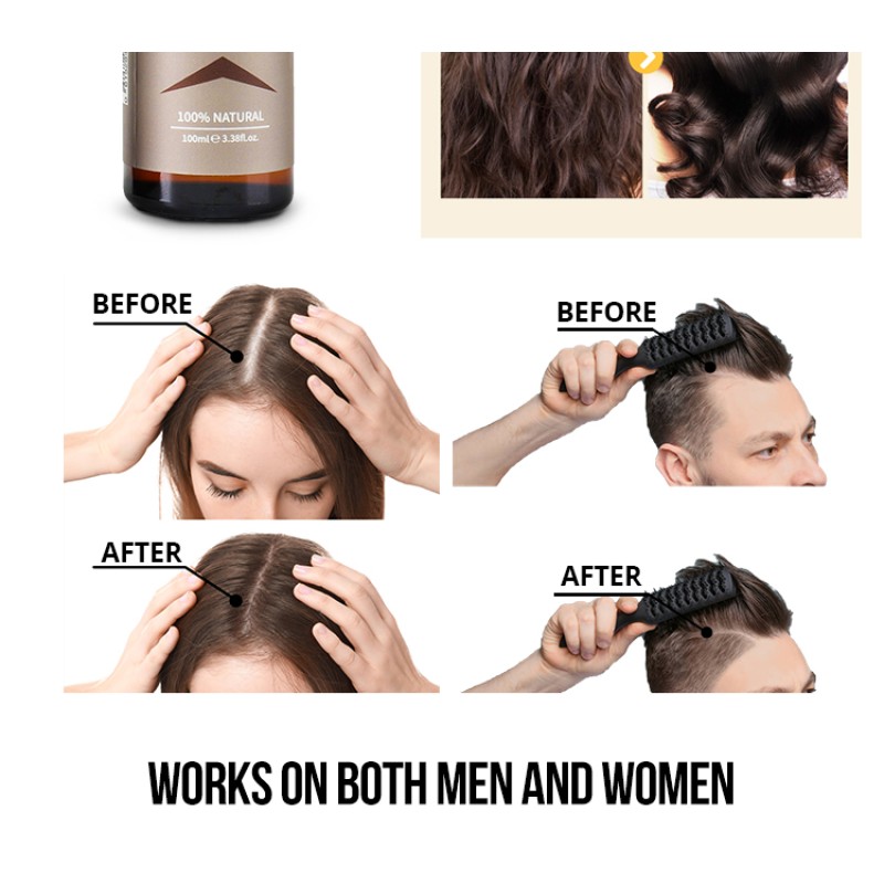 Hair Growth Oil Supplier - OEM Ginger Aloe Vera Vitamin E Custom Logo