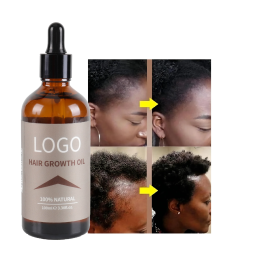 Hair Growth Serum Factory - Bulk 7 Days Essential Oil Natural Organic