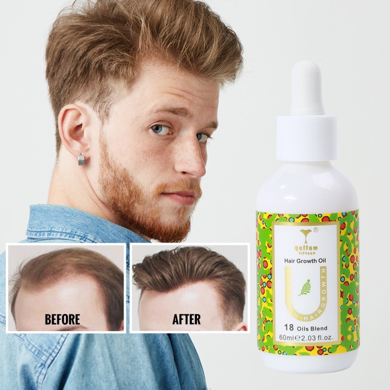 Hair Serum Oil Manufacturer - Bulk Rosemary Biotin for Hair Growth