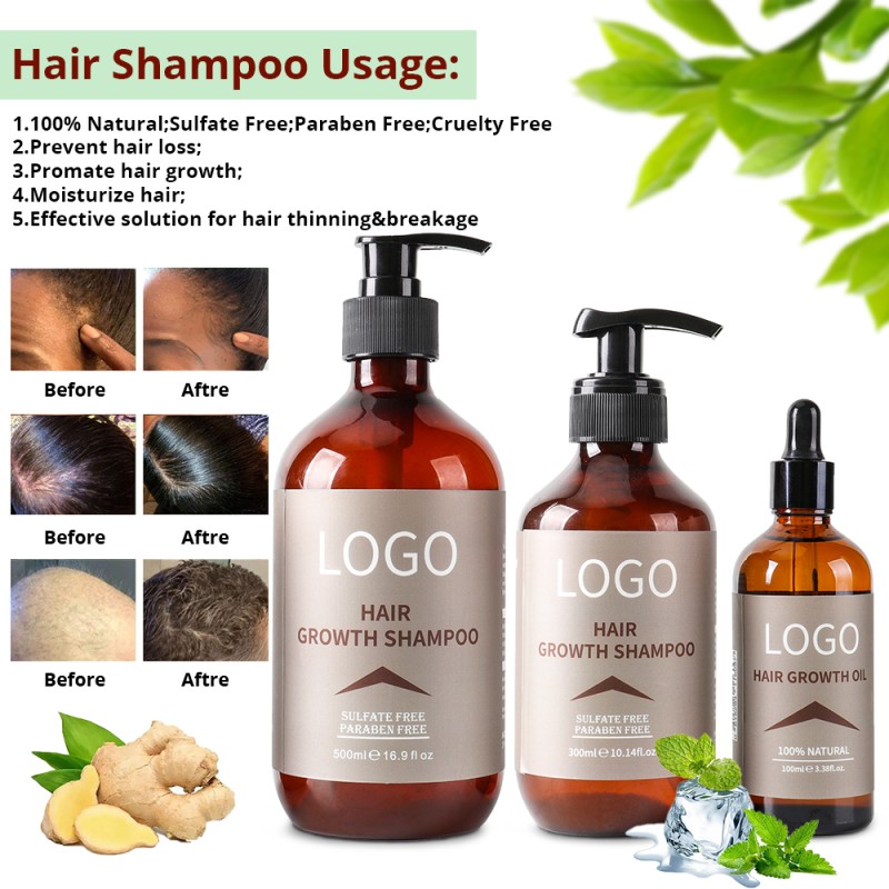 Hair Growth Set Supplier - OEM Anti Hair Loss Solid Natural Ginger