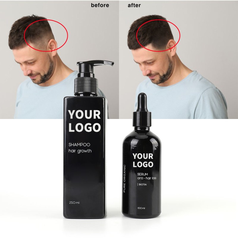 Professional Shampoo Supplier - OEM Organic Natural Ginger for Hair Care