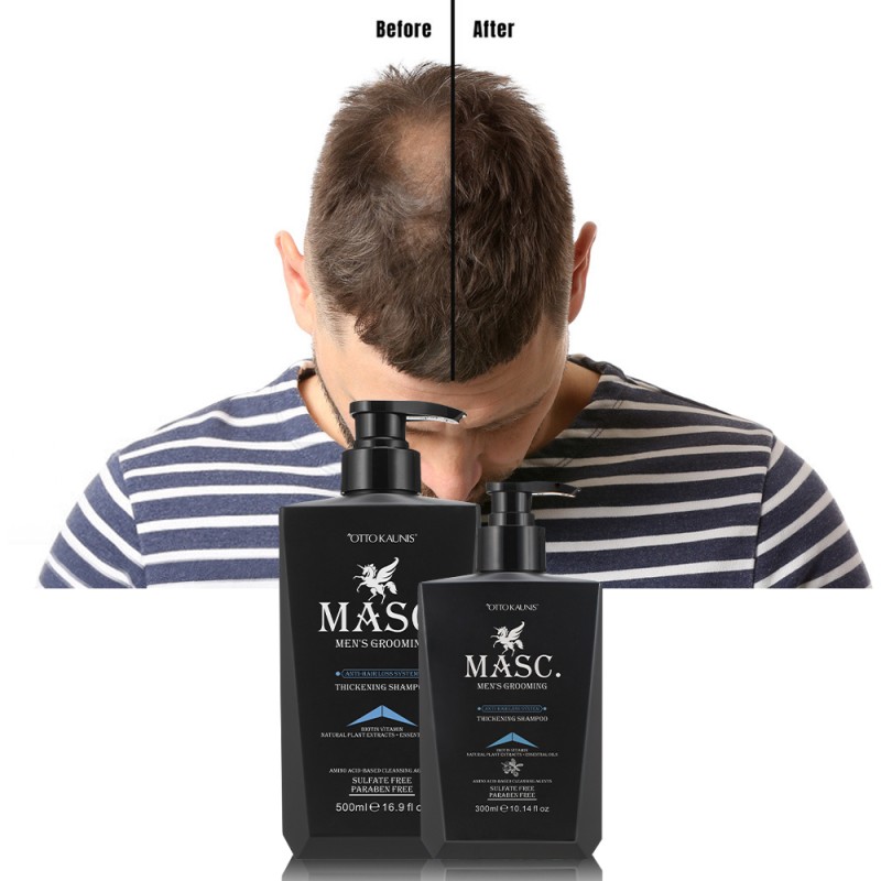 Anti Hair Loss Shampoo Supplier - Bulk Organic Natural Prevention for Men Women