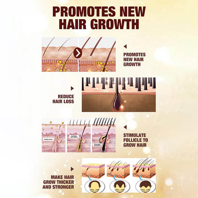 Hair Growth Set Supplier - OEM Anti Hair Loss Solid Natural Ginger