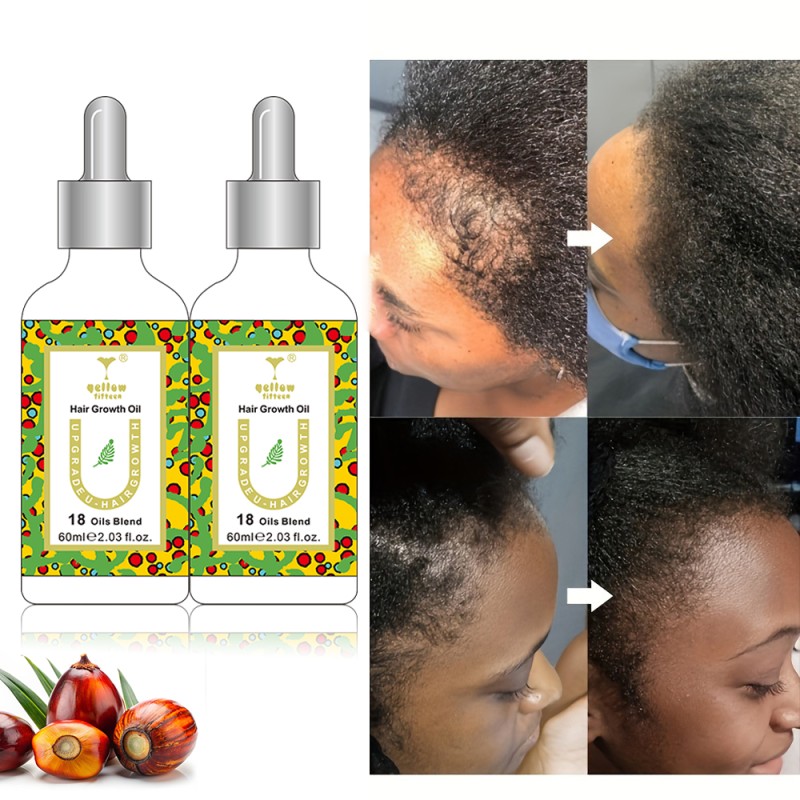 Hair Serum Oil Manufacturer - Bulk Rosemary Biotin for Hair Growth