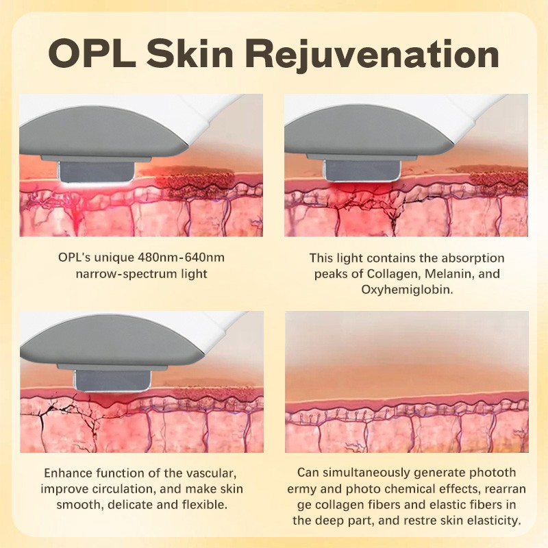 Hair Removal Machine Manufacturer - OEM Skin Rejuvenation Permanent OPT