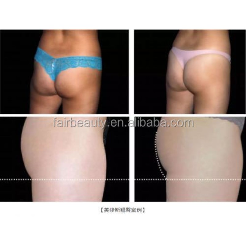 Beauty Machine Factory - OEM Farslim Fat Reduction Muscle Stimulator