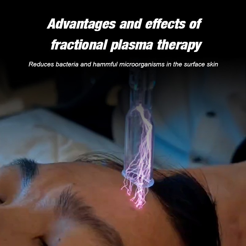 Plasma Pen Manufacturer - OEM Wholesale Electric Pigment Removal