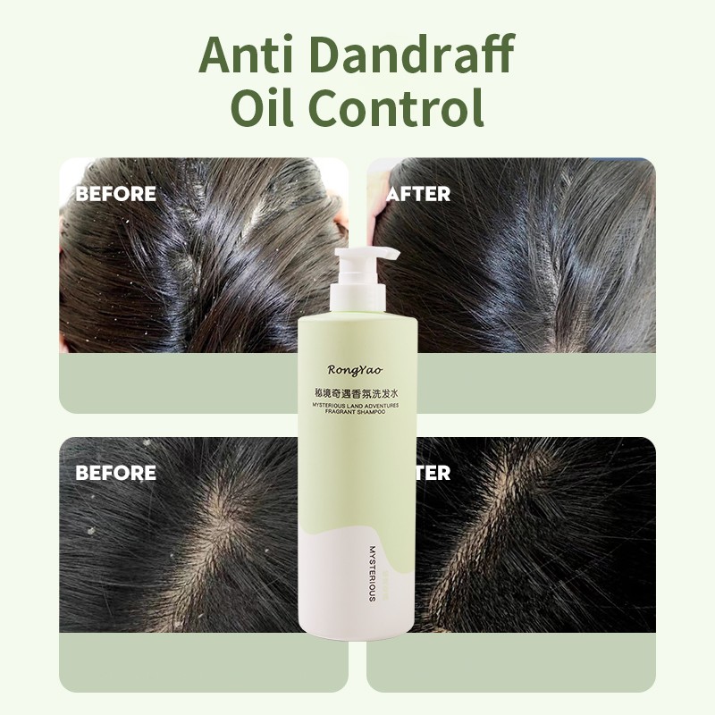 Shower Set Manufacturer - Rongyao Private Label Anti Loss Fragrance