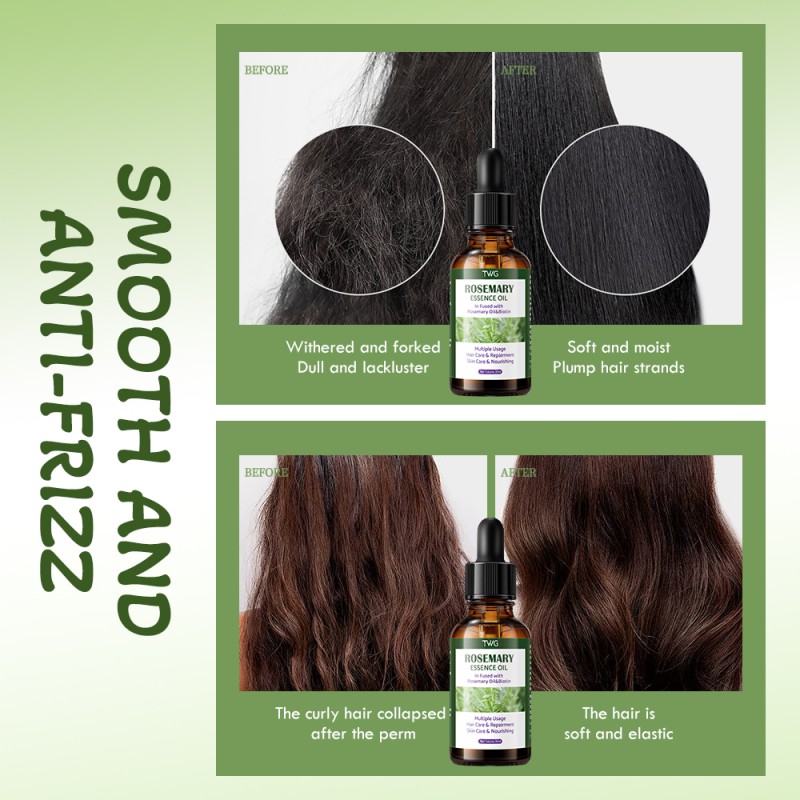 Essence Oil Factory - TWG Hot Selling All in 1 Rosemary Biotin