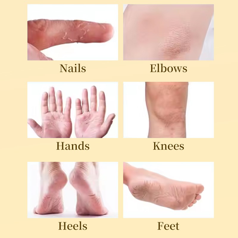 Body Cream Manufacturer - TWG Private Label Lanolin Anti Cracking