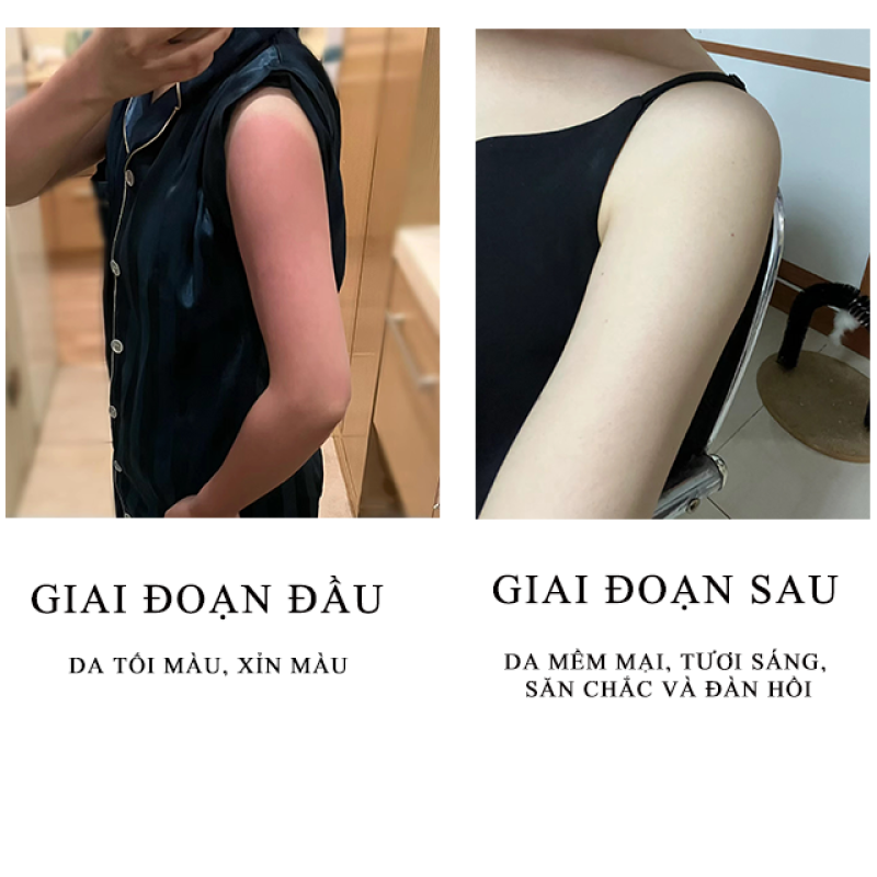 Face Whitening Cream Manufacturer - Bulk Otesaly Formula Whitening Producer