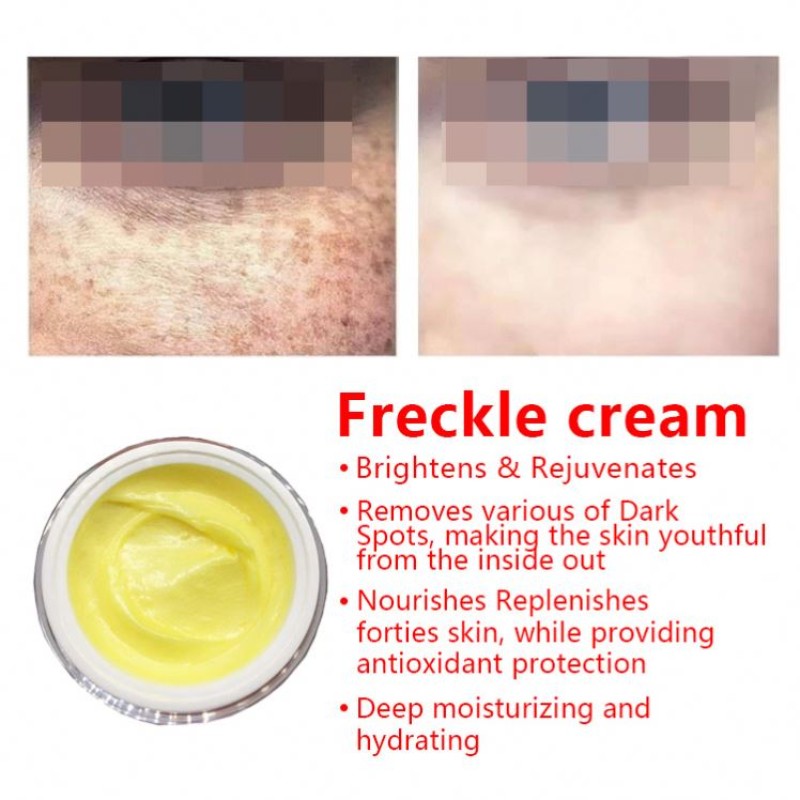 Freckle Removal Cream Supplier - OEM Herbal Plant Extract Dark Spot Corrector