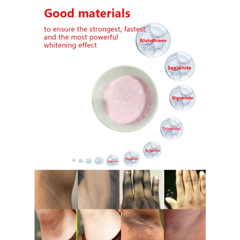 3-Day Whitening Cream Supplier - OEM Facial Private Parts Knee Elbow Bleaching