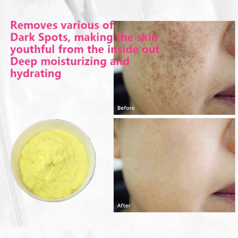 Underarm Whitening Cream Factory - Bulk Sakura Formula Adult Armpit Lightening