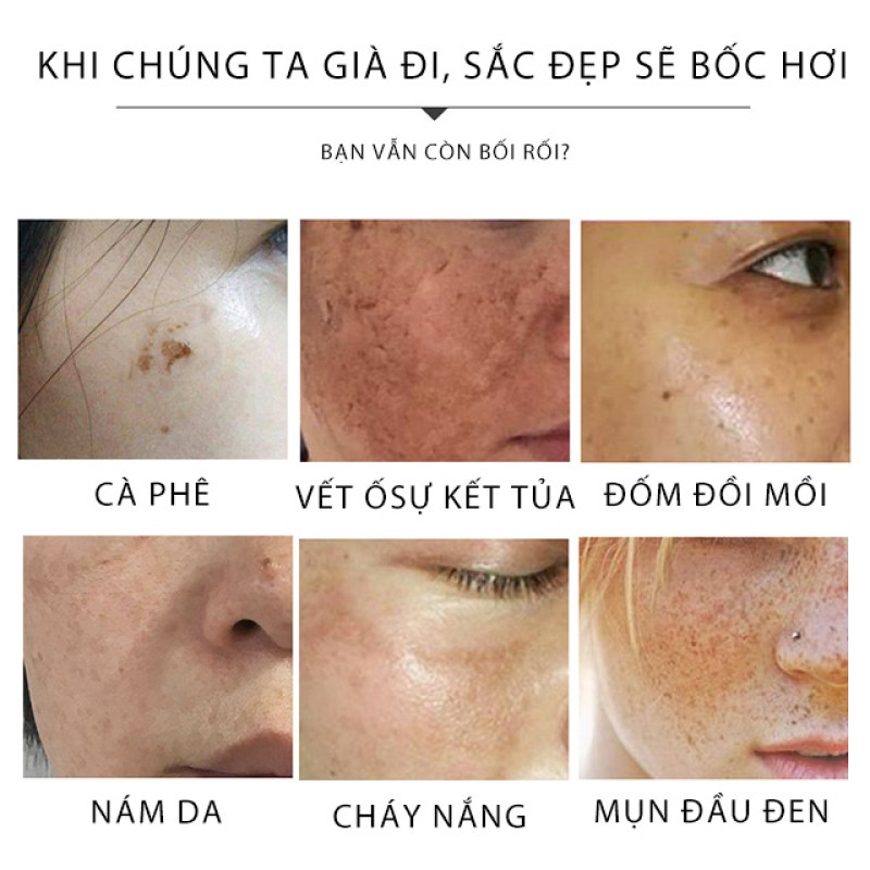 Whitening Lotion Factory - OEM Caro Light White Body Cream Semi-Finished