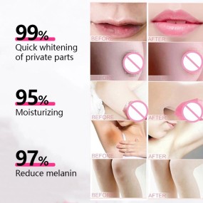 Intimate Whitening Cream Supplier - Bulk Underarm Bleaching Serum for Dark Areas