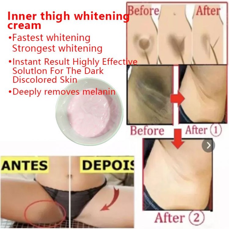 Turmeric Whitening Cream Supplier - Bulk Vietnam Formula Hydrating Body Lightening