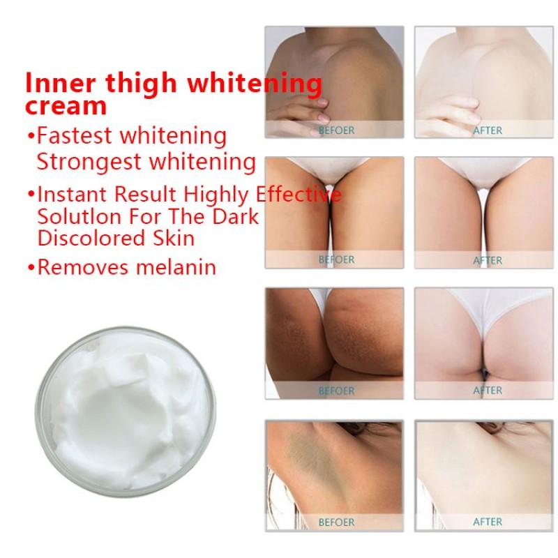 Chinese Whitening Cream Manufacturer - OEM All Skin Types Dark Spot Removal