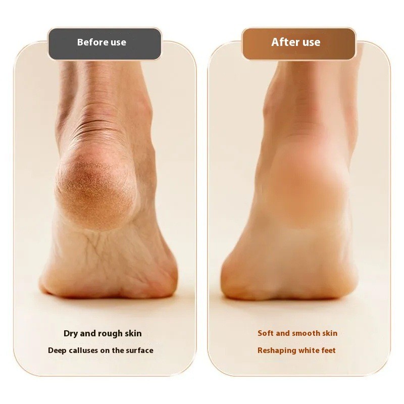 Foot File Supplier - OEM Rechargeable Upgraded Grinding Device