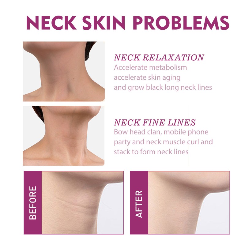 Neck Cream Supplier - OEM New 40g Hydrolyzed Collagen Tightening