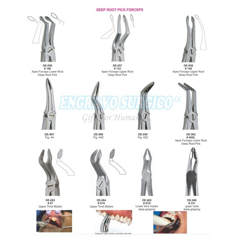 Tooth Forceps Factory - Hot Sale Lower Molar English Pattern