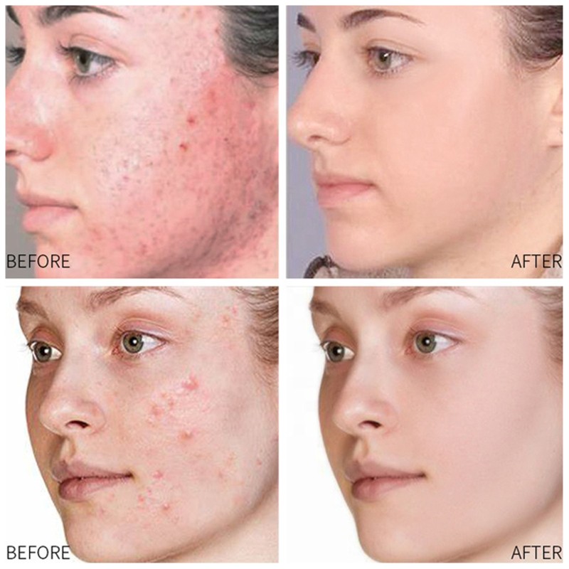 Herbal Cleanser Manufacturer - Bulk Hot Selling Deep Cleansing Refreshing