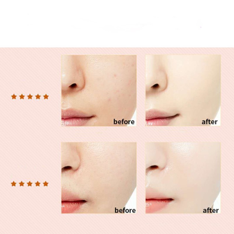 Foundation Supplier - Bulk High Quality Moisture Waterproof Matte