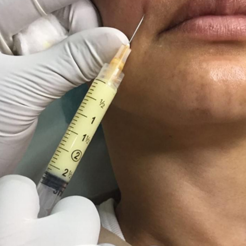 Plasma Gel Maker Manufacturer - OEM/ODM IKEME PRF PPP Gel Bio Filler Machine Biofiller