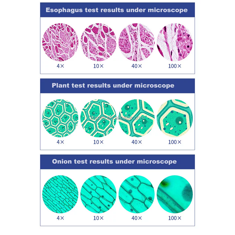 Medical Microscope Factory - OEM/ODM IKEME Lab Portable Binocular Digital Biological Olympus