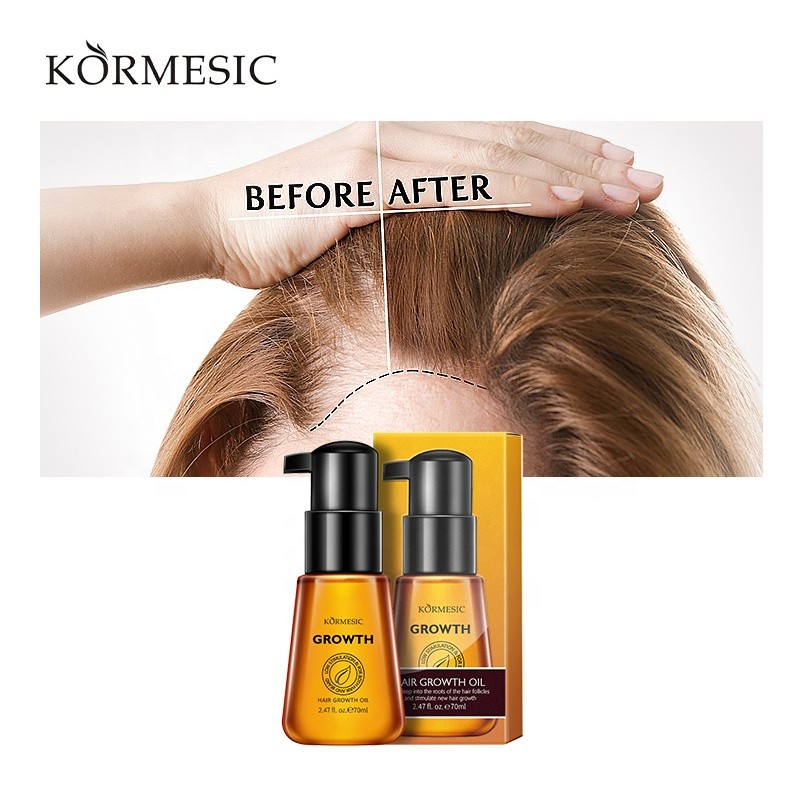 Hair Growth Oil Manufacturer - Bulk Repairing Anti Loss Regrowth Organic