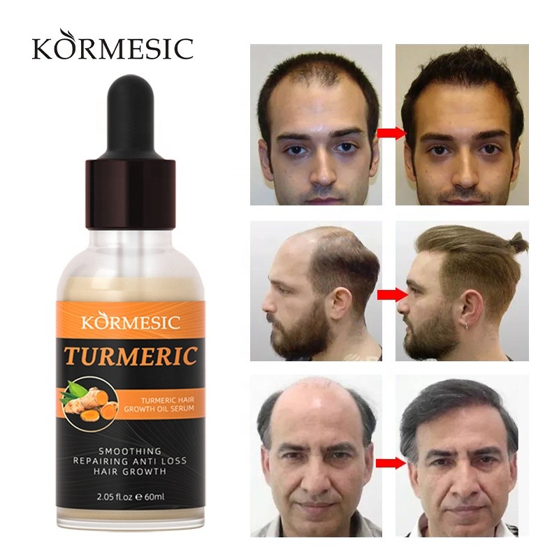 Hair Growth Oil Factory - Bulk Strengthening Repair Extract Growth