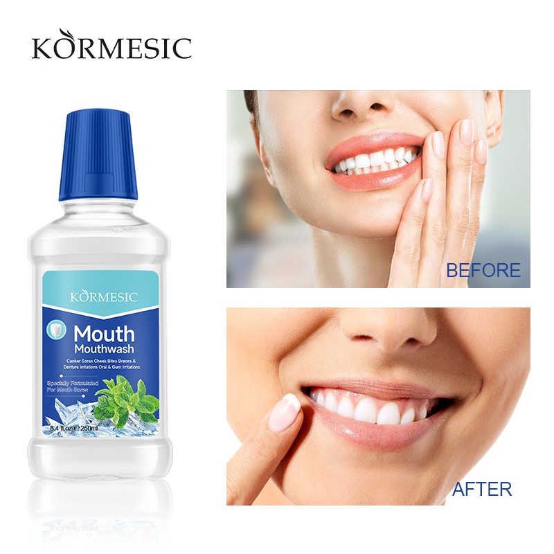 Liquid Mouthwash Factory - Bulk Portable Packaging Teeth Whitening Travel