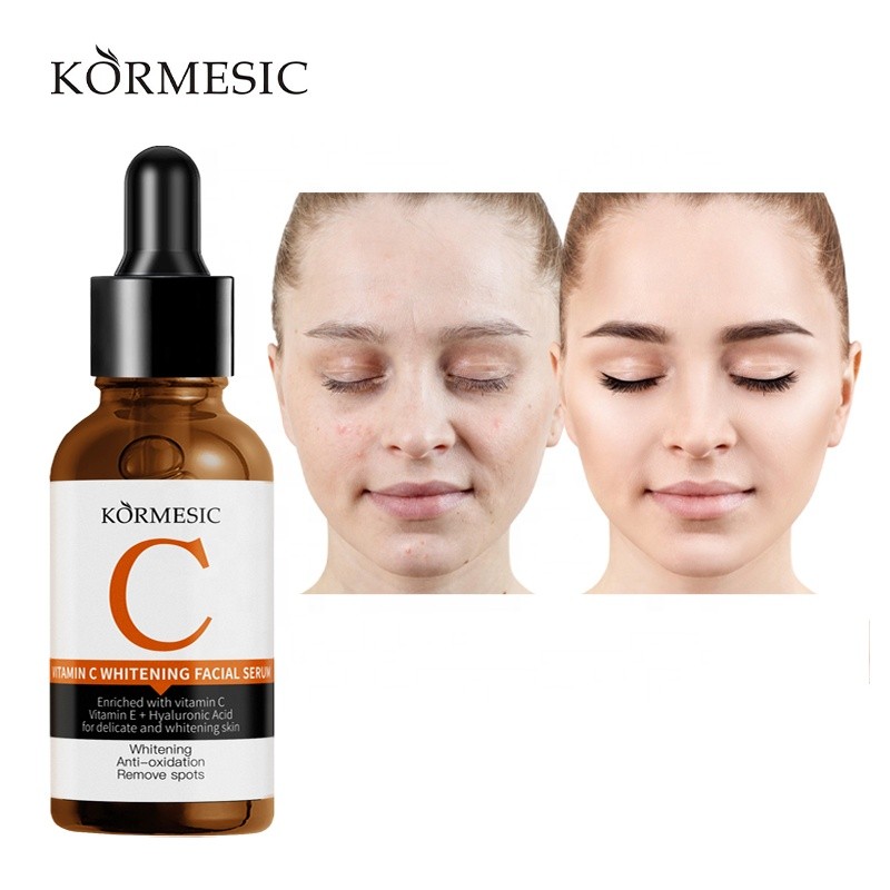 Anti Wrinkle Serum Supplier - OEM Lightening Amino Acid Vitamin E