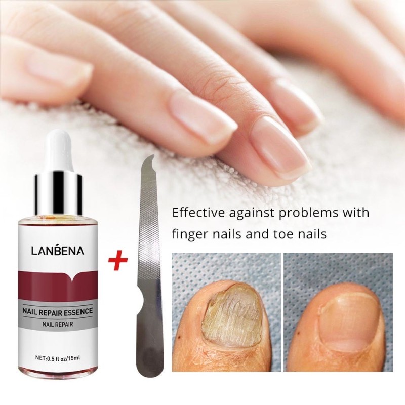 Nail Repair Serum Factory - OEM Fungal Nail Treatment