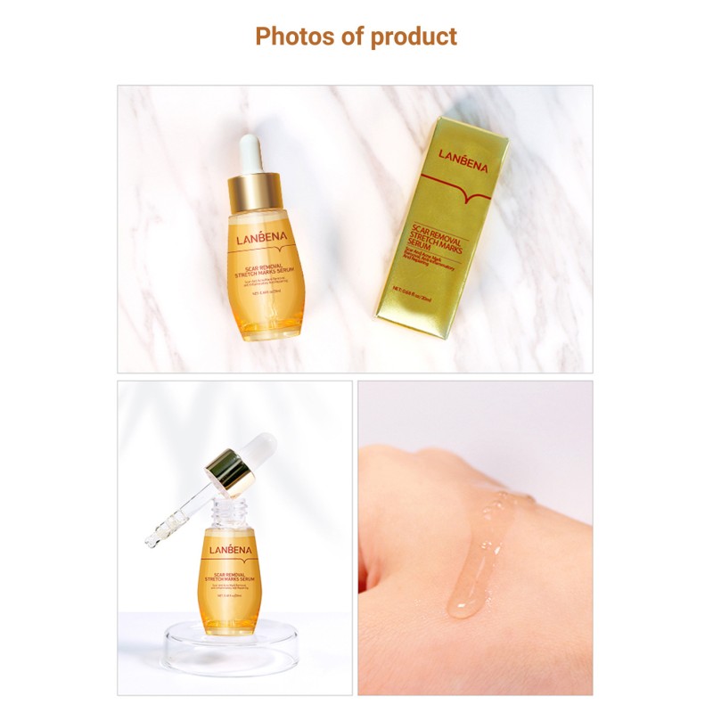 Acne Treatment Serum Factory - OEM Scar Removal Cream