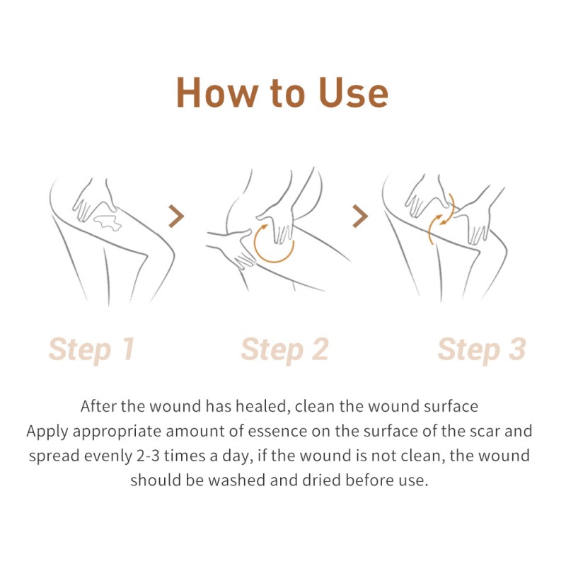 Acne Treatment Serum Factory - OEM Scar Removal Cream