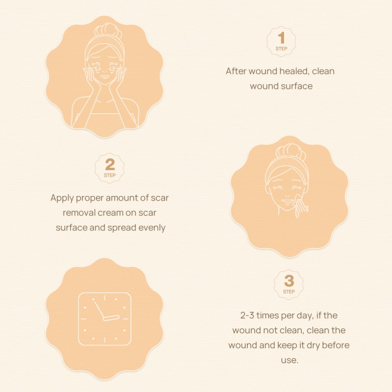 Scar Removal Cream Factory - OEM Stretch Marks Treatment