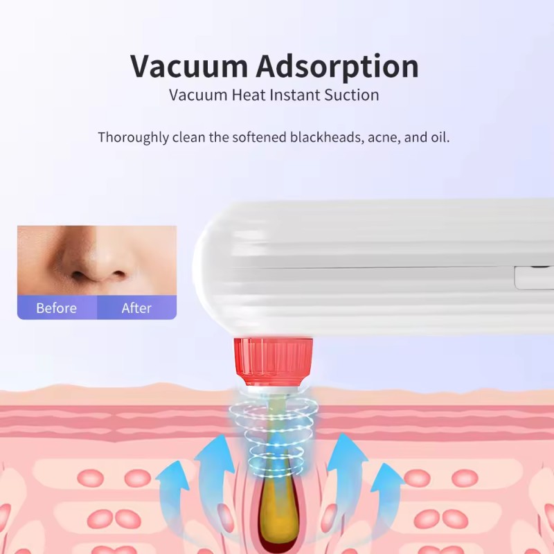 Blackhead Remover Manufacturer - OEM Red Blue Light Acne