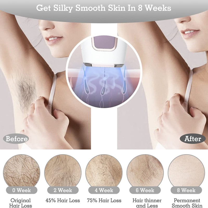 IPL Machine Manufacturer - OEM 510K Painless Hair Removal