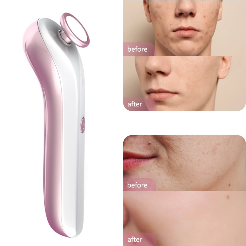 Skin Cleaning Instrument Factory - OEM Plasma Beauty Device