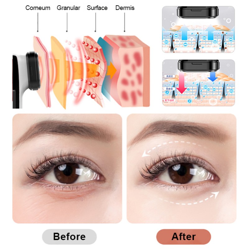 RF Beauty Instrument Manufacturer - OEM LED Anti-Wrinkle Machine