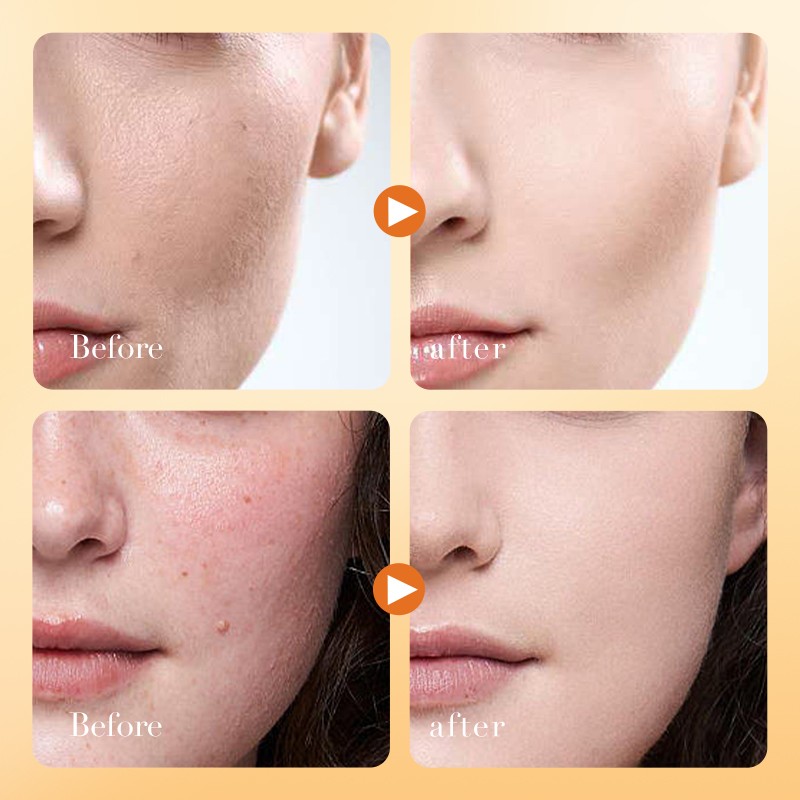 Face Cream Manufacturer - OEM Vitamin C Brightening