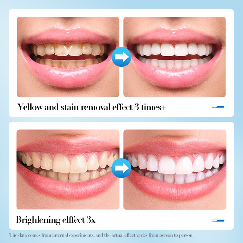 Tooth Powder Factory - OEM Baking Soda Whitening Powder