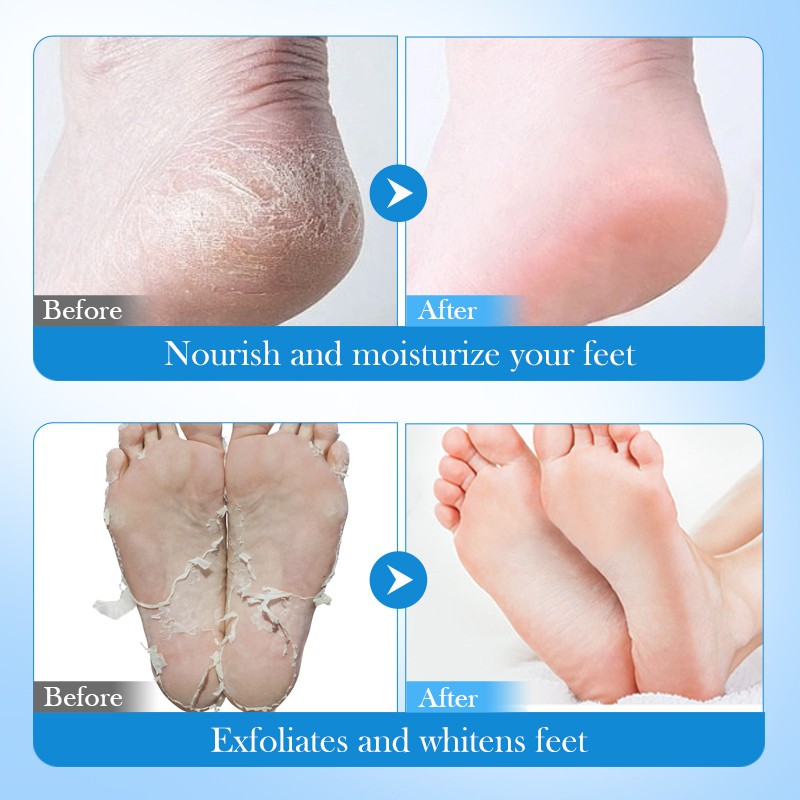 Foot Mask Manufacturer - OEM Avocado Petroleum Jelly