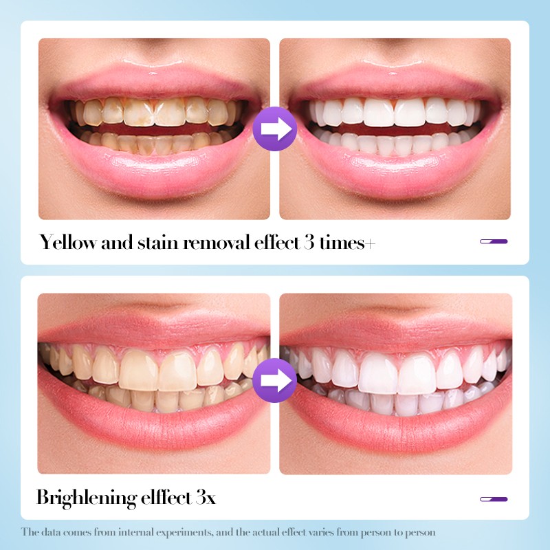 Teeth Whitening Powder Manufacturer - OEM Mint Flavor Powder