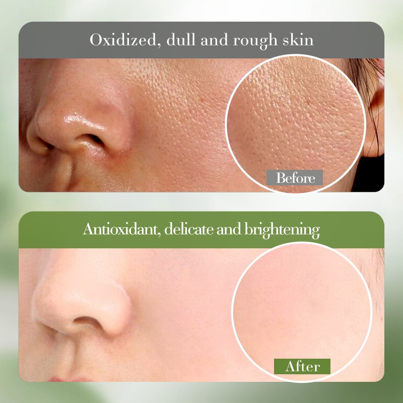 Facial Serum Factory - OEM Whitening Anti Wrinkle